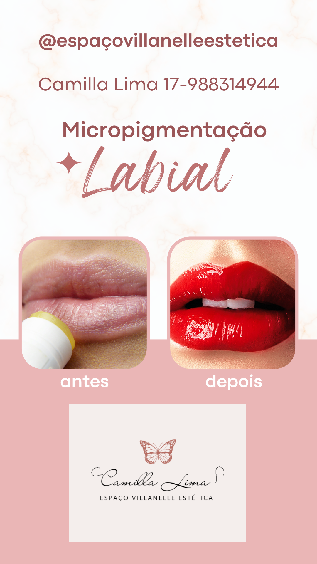 Resultado antes e depois Micropigmentação Labial Esteticista Moderno Rose N_20240610_235117_0000